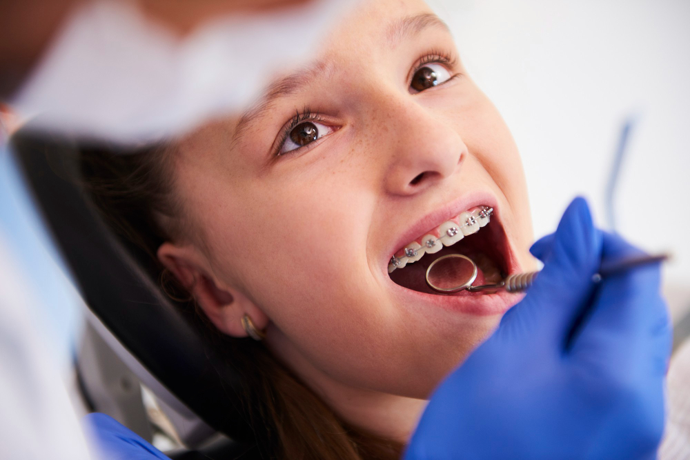 Braces & Clear Aligners