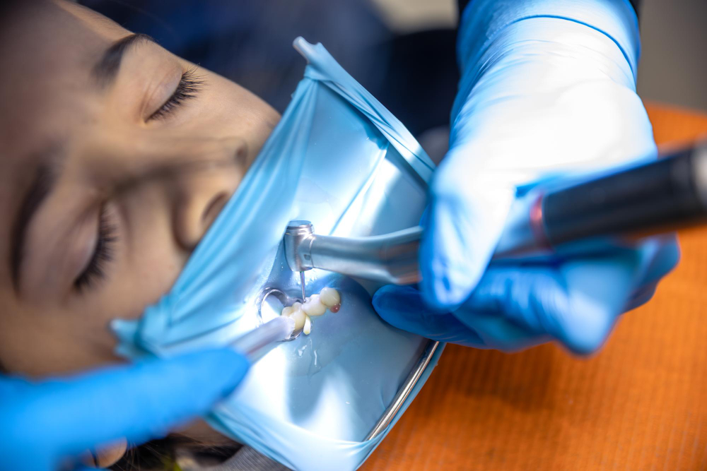 Root Canal Treatment (RCT)