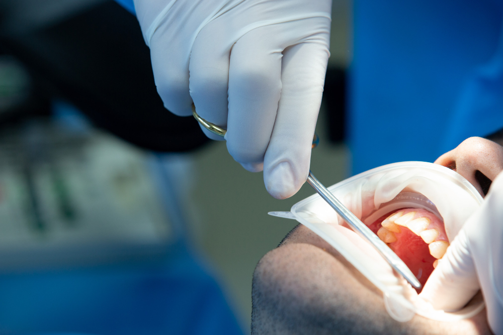 Tooth Extractions & Minor Surgeries